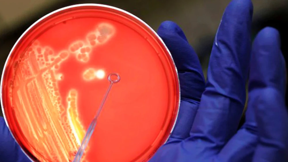 Un nuevo antibiótico es prometedor contra una bacteria polirresistente