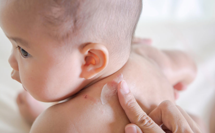 ¿Se puede aplicar repelente contra mosquitos en bebés? Salud responde